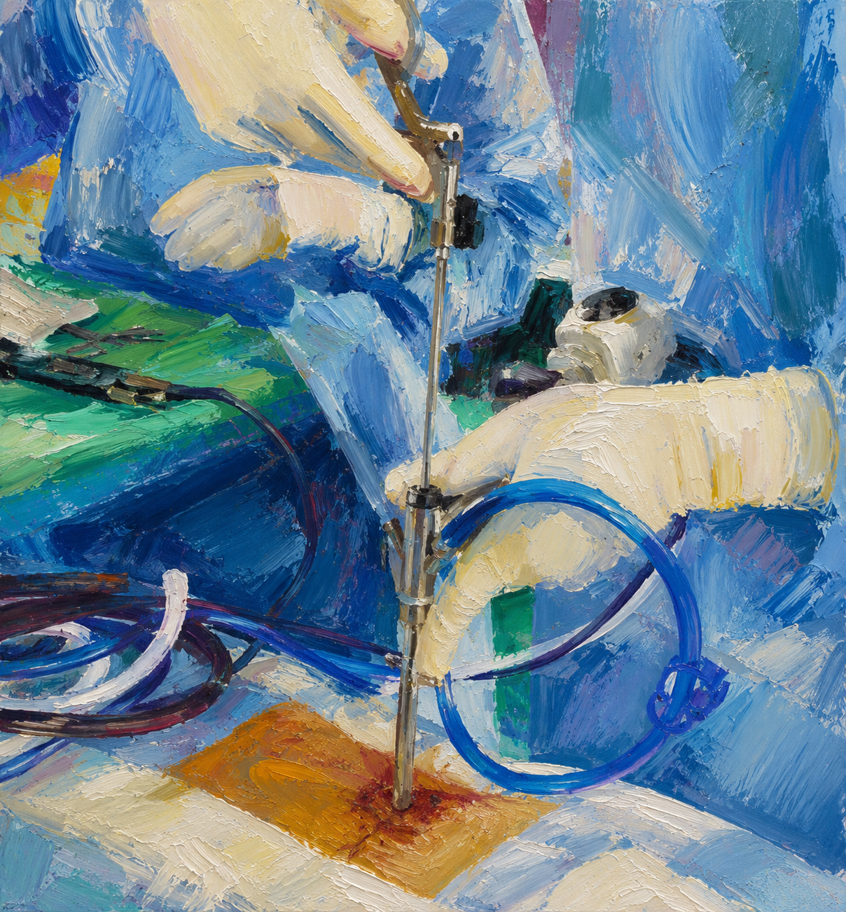 Close-up of surgical technology used in minimally invasive spine procedures